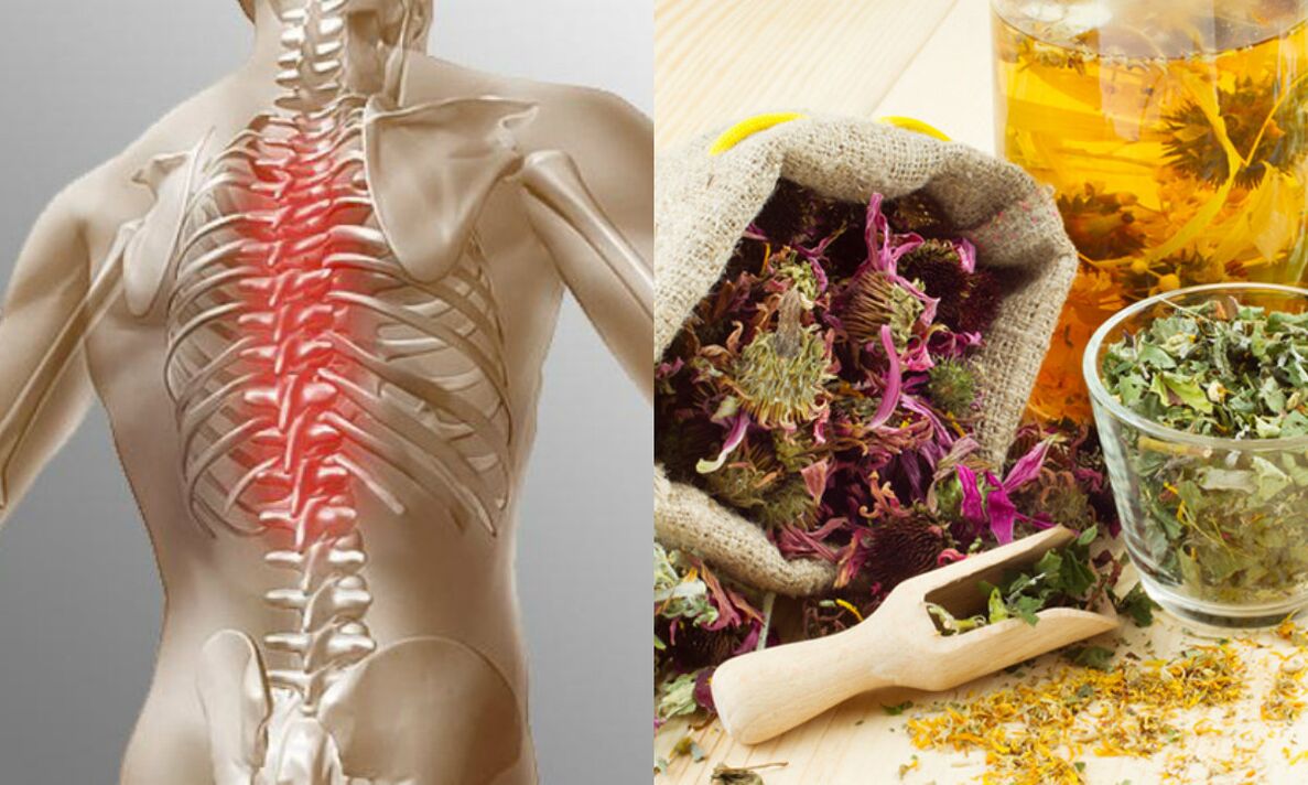 neck osteochondrosis folk methods