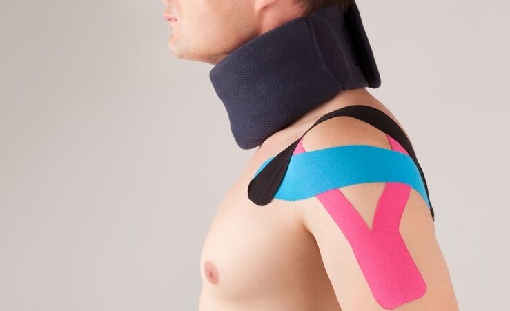 During the acute period of cervical osteochondrosis, a special collar must be worn